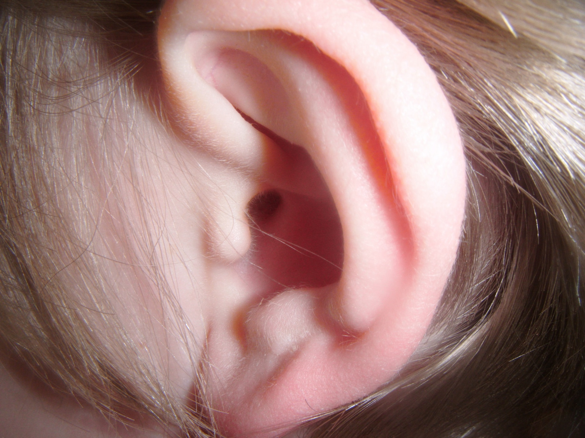 Longevity Briefs Novel Tongue And Ear Stimulating Device For Tinnitus